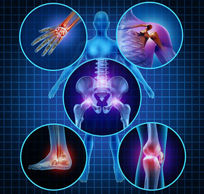 Quiropractica dolor artritis o artrosis