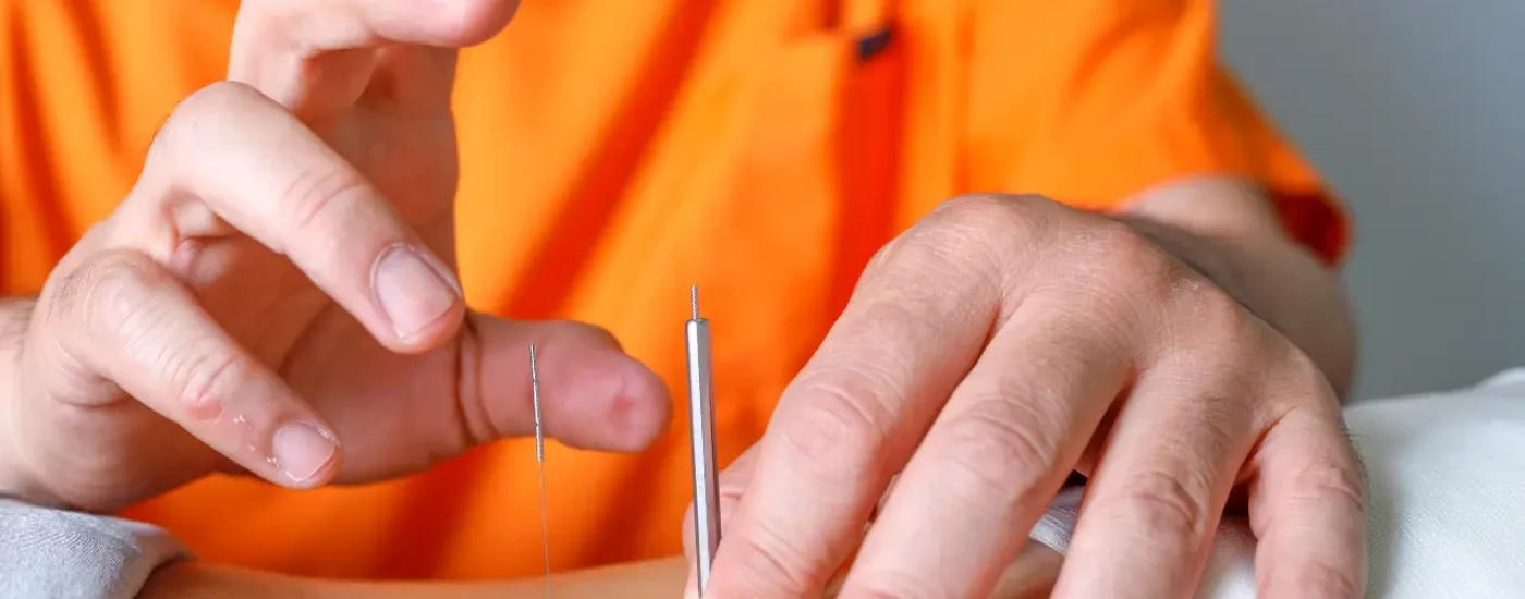 Acupuntura en qué dolencia