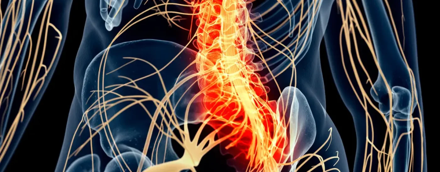 Nervio atrapado y Osteopatía