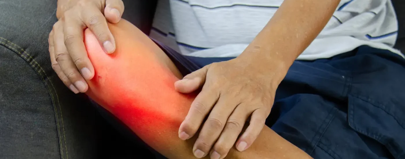 Indicios de Artrosis