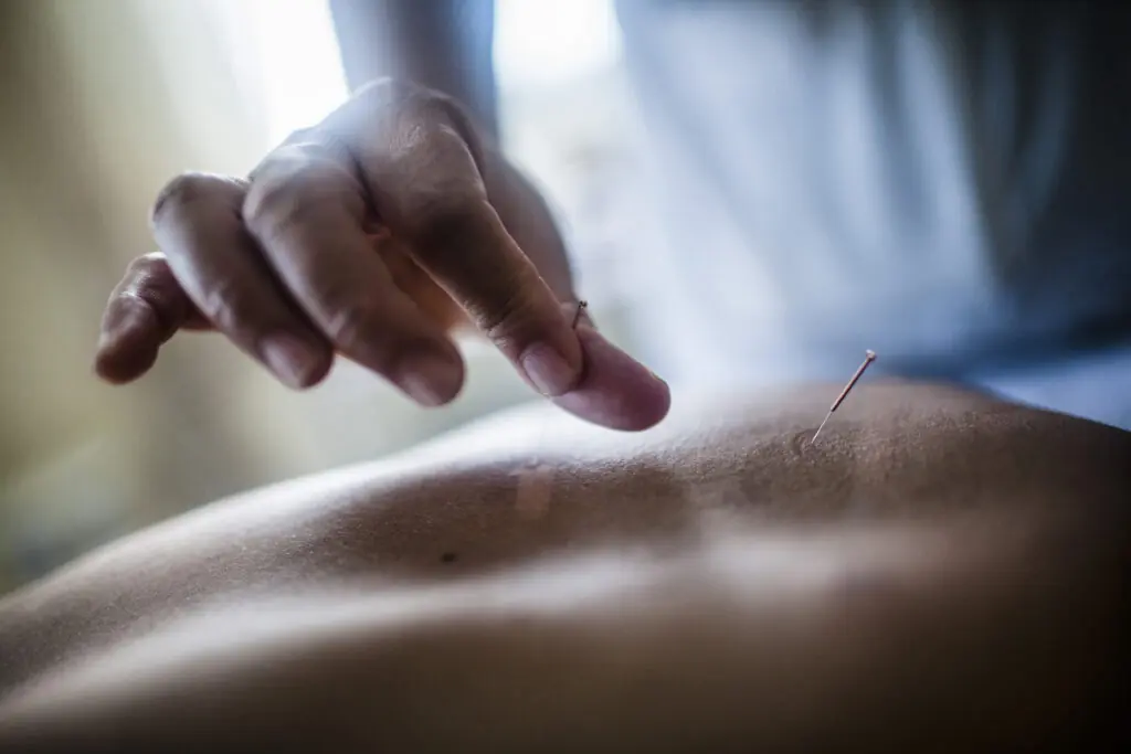 acupuntura Alicante